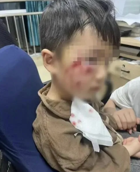 被疯犬咬伤没有“救命药”，怎么办？